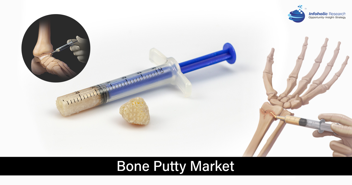 bone putty market