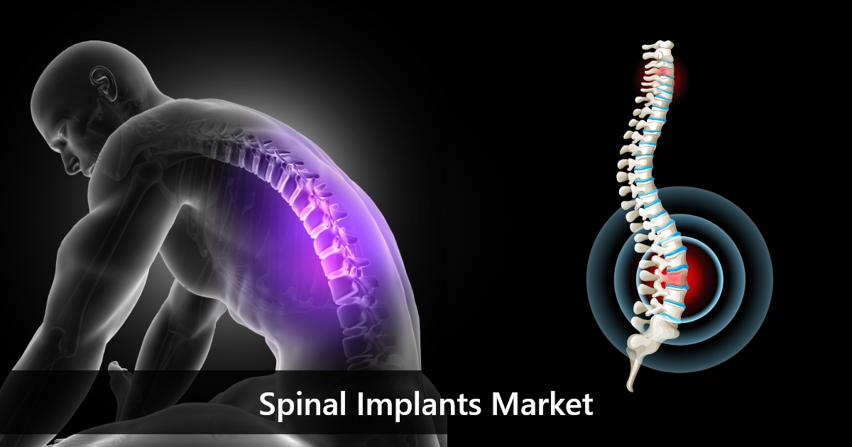 spinal-implants-market