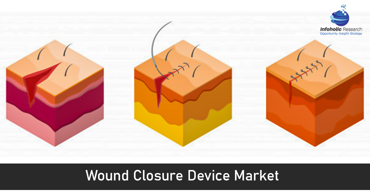 wound-closure-devices-market